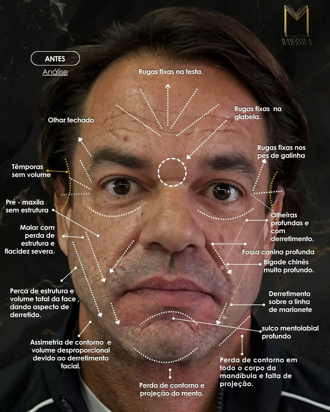 A análise que sai da avaliação presencial